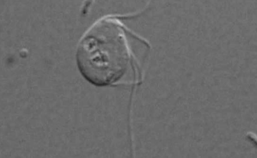 This is a light micrograph of the microbe that evolutionary biologists say lives just fine without any mitochondria.