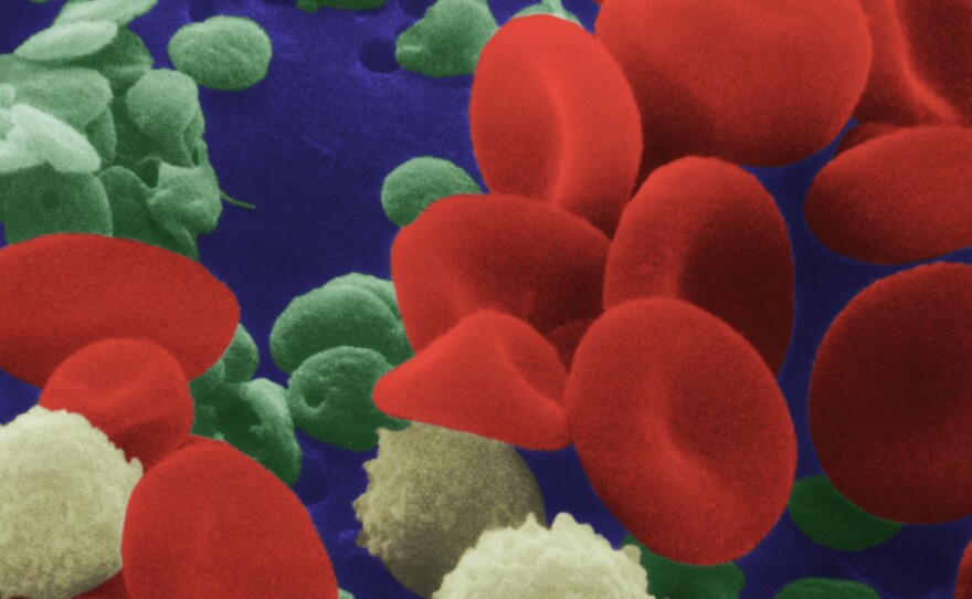 Plump red blood cells — tumbling amid the infection-fighting white cells and purple platelets in this colorized, microscopic view — need adequate levels of iron to be able to carry and deliver oxygen around the body.