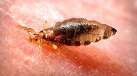 Head lice. Fossils can tell us a lot about human evolution, but still leave many questions unanswered. After sucking our blood for millions of years, lice are suddenly proving their value: Their DNA turns out to hold a treasure trove of clues about our evolution.