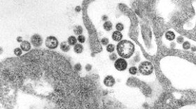Lassa Fever under a microscope. 