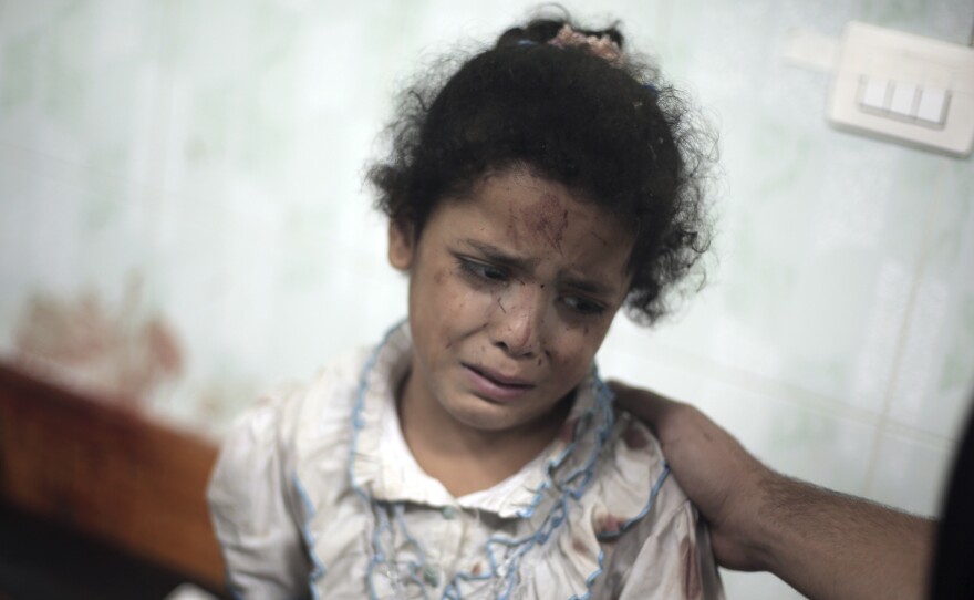 A Palestinian girl cries while receiving treatment at a hospital in the Gaza Strip following shelling in July of a U.N. school in the Jebaliya refugee camp.