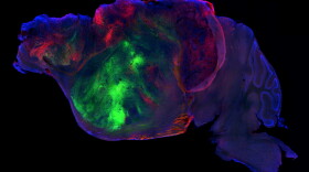 This side view of a lab mouse brain shows nerve fibers extending from the human graft (colored with green and red fluorescent proteins) through the mouse brain (colored with blue). Scale bar = 1 mm.