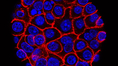 This undated microscope image from USC via the NIH shows pancreatic cancer cells, nuclei in blue, growing as a sphere encased in membranes, red.