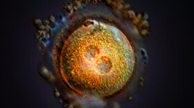 This computer-generated image shows the formation of a zygote after fertilization. Some Republican-led states, including Arkansas, Kentucky, Missouri, and Oklahoma, have passed laws declaring that life begins at fertilization, a contention that opens the door to a host of pregnancy-related litigation.