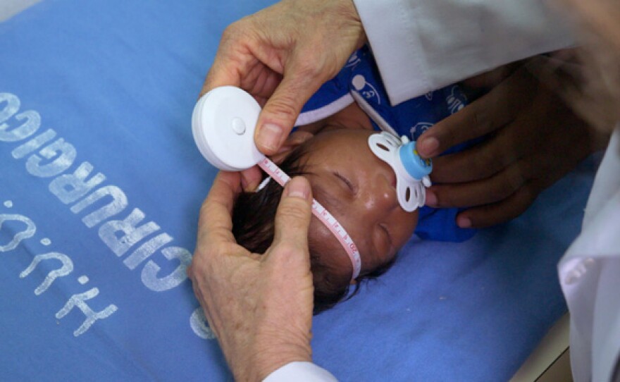 Samuel da Silva, an infant with microcephaly, has his head circumference measured at Oswaldo Cruz University Hospital in Recife, Brazil.