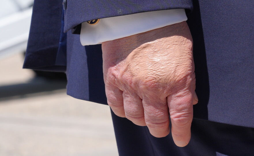 President Donald Trump's right hand is seen as he speaks to the press after returning and stepping off Air Force One, Wednesday, May 20, 2026, at Joint Base Andrews, Md., after speaking at the U.S. Coast Guard Academy commencement.