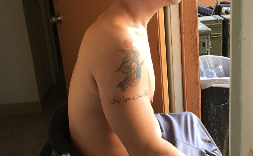 In 2016, Lammers had lost weight when he took up adaptive swimming.