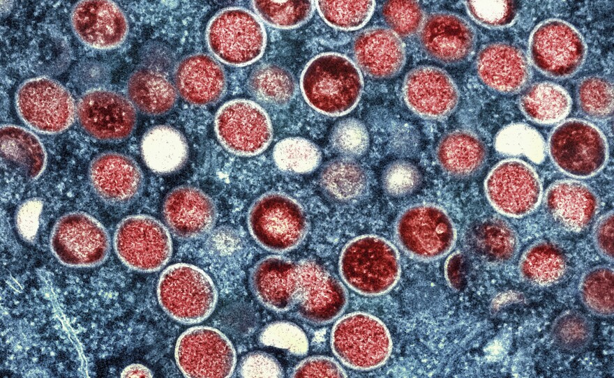 A colorized transmission electron micrograph of monkeypox particles (red) found within an infected cell (blue), cultured in the laboratory that was captured and color-enhanced at the National Institute of Allergy and Infectious Diseases Integrated Research Facility in Fort Detrick, Md.
