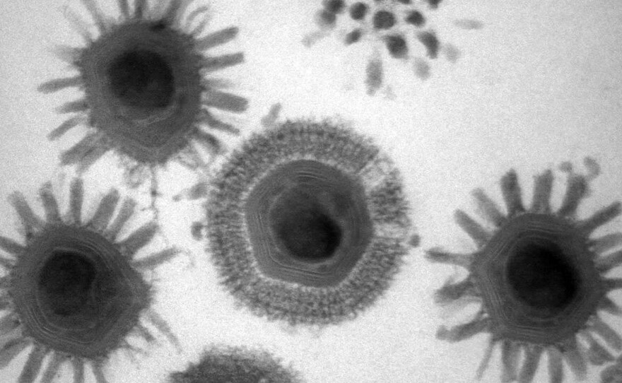 In 2003, Acanthamoeba polyphaga mimivirus, also known as mimivirus, was the first giant virus to be described. It's larger than many bacteria, and was found in a water sample from a hospital cooling tower in England.