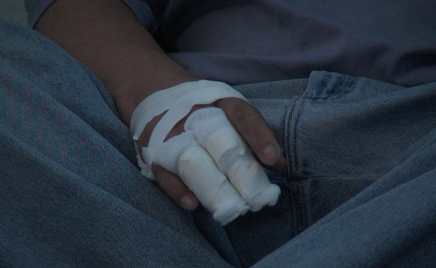 The bandaged hand of a resident at the Tijuana rehabilitation center DAR, May 1, 2015.