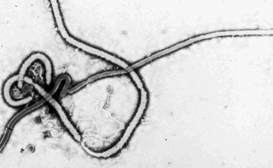 An electron micrograph photo of the Ebola virus, provided by the Centers for Disease Control and Prevention in Atlanta.