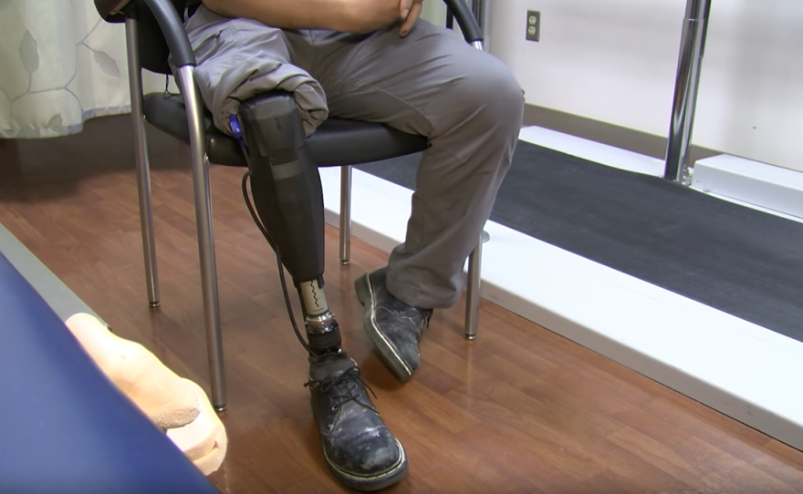 The photo shows the prosthetic leg of a Navy veteran, March 22, 2017.