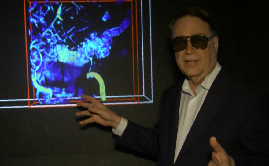 UC San Diego computer science professor Larry Smarr stands in front of a 3D representation of his internal organs, Feb. 22, 2017.