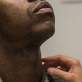 Staff Sgt. Antoine raises his head as a flight surgeon inspects his neck and face during a 2018 shaving waiver course at Beale Air Force Base in California.