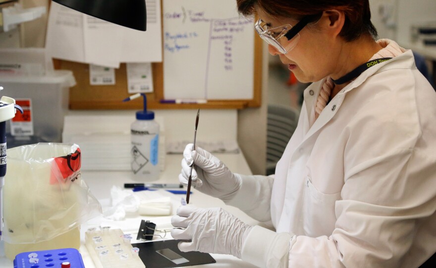 Microbiologist Mi Kang works to identify a strain of E. coli from a specimen in a lab at the Washington State Dept. of Health Tuesday, Nov. 3, 2015, in Shoreline, Wash.