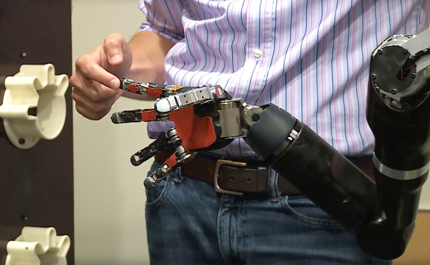Each time a particular finger on a robotic hand is touched, a blindfolded Nathan Copeland "feels" as if his own finger were being touched, thanks to a brain implant. That sort of sensory feedback could help him hold a fragile object without crushing it.