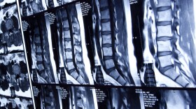 Errors in reading diagnostic images like MRIs or CT scans can lead to unnecessary and costly medical procedures. Walmart is pushing its employees to use a vetted list of high-quality imaging centers to avoid errors.