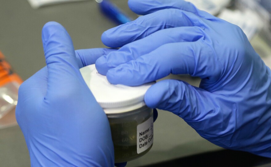 A Florida Department of Health employee processes a urine sample to test for the Zika virus on Sept. 14 in Miami Beach.