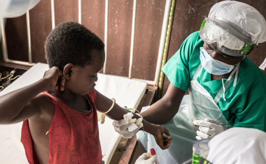 Blood samples are drawn from a boy who didn't display any sign of monkeypox despite his all family has been contaminated in the Central African Republic in 2018.
