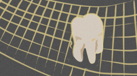 Most California dentists refuse to participate in the “Denti-Cal” program, leaving patients with impossible wait times that lead to lost teeth, horror stories and expensive health consequences.
