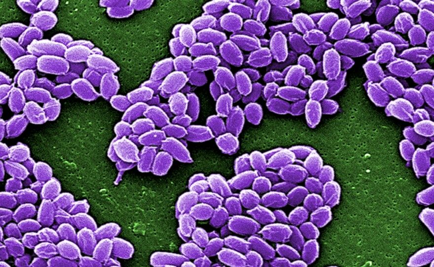 Spores of the anthrax bacteria (Bacillus anthracis) can survive for decades in the soil, scientists say. The spores, shown here under a scanning electron microscope, are tough to kill.