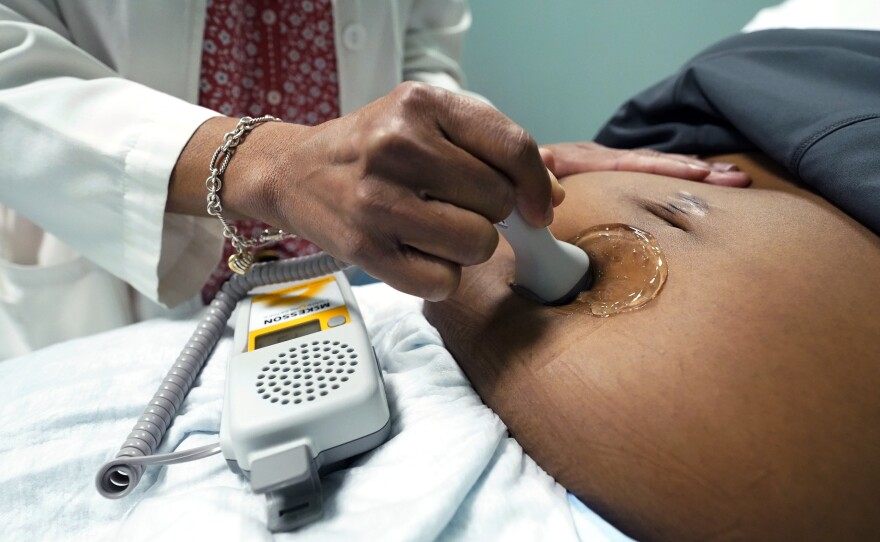 File photo of a doctor using a hand-held Doppler probe on a pregnant woman to measure the heartbeat of the fetus on Dec. 17, 2021, in Jackson, Miss.