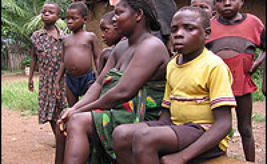 Monday Mweke, age 9, seen here with his mother, wasn't able to help his family with chores such as fetching water and wood during his bout with guinea worm.