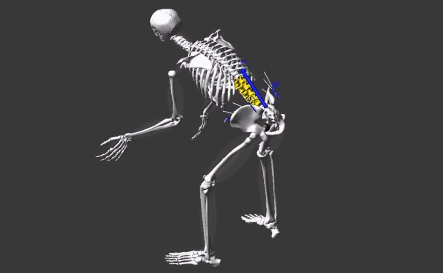 The screenshot from a simulation video shows the magnitude and distribution of forces NPR correspondent Daniel Zwerdling endured on his spine while re-creating the way nurses lift patients from their beds.