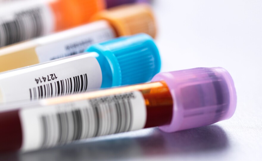 "I'm afraid there's a growing sense that the path to health is through testing," says Dr. H. Gilbert Welch, a Dartmouth Institute internist who has written books on the pitfalls of overdiagnosis. Encouraging the worried well to order their own blood tests feeds that mindset, he says.