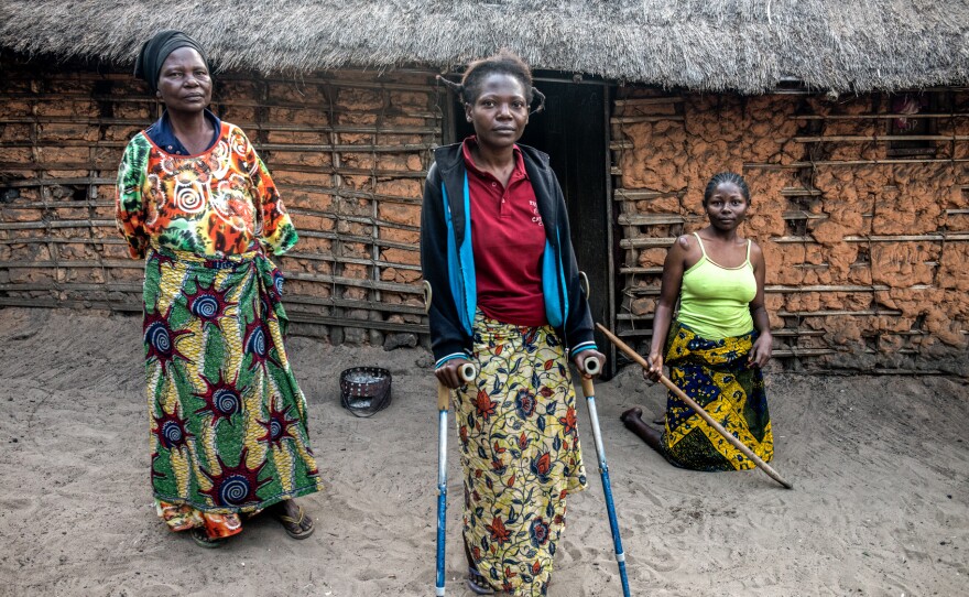 (From left) Cécile Mwandjombi and her two daughters, Nov Lutondo, 27, and Ruth Lutondo, 24, who have been disabled by konzo.