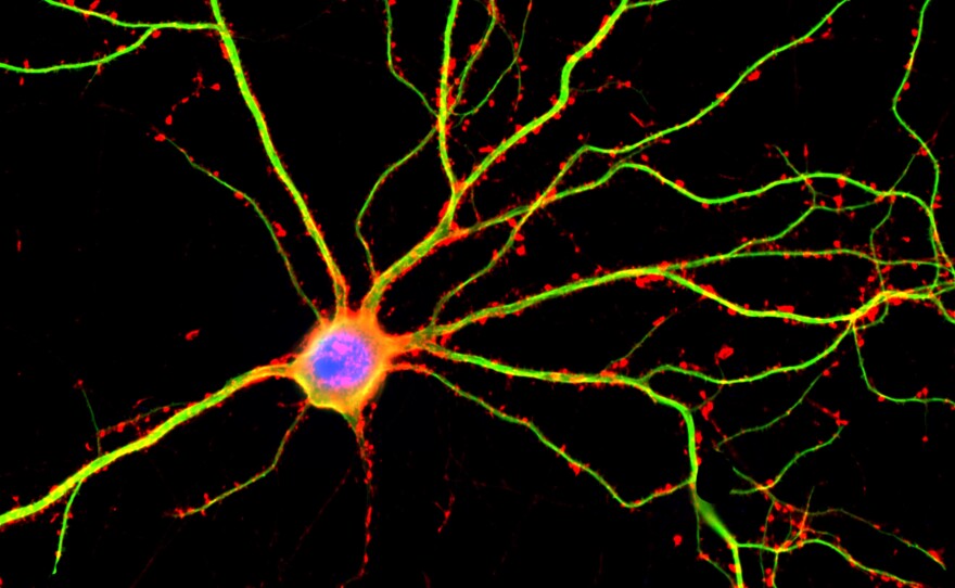 A hippocampal neuron seen in culture. Dendrites are green, dendritic spines are red and DNA is blue.