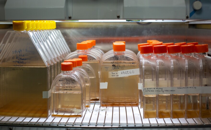 Algae in Nitschke's lab, grown over hundreds of generations. They've been exposed to heat, singling out those best able to handle higher temperatures, which then go to produce more heat-tolerant algae.
