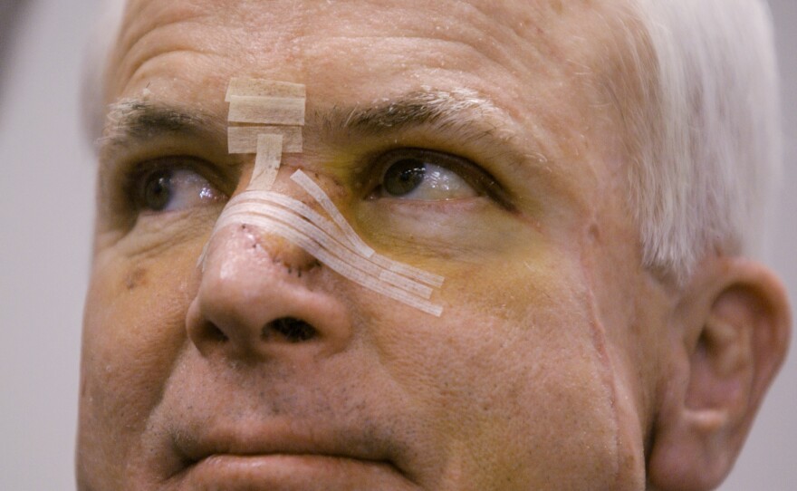 Former presidential candidate John McCain in 2002, with a bandaged nose after being treated for skin cancer. As a candidate, McCain was open about his health and allowed reporters to review more than 1,000 pages of his records over three hours.