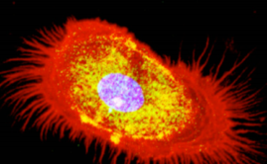 A leukemia cell is shown, Oct. 19, 2015.