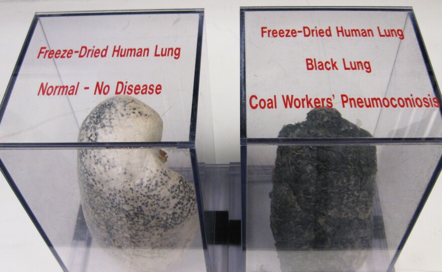 A display case at NIOSH shows a normal lung and a diseased black lung, caused by inhaling coal dust and other harmful particles while coal mining.