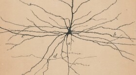 Pyramidal neurons are among the few neurons in the brain that can be seen with the naked eye.