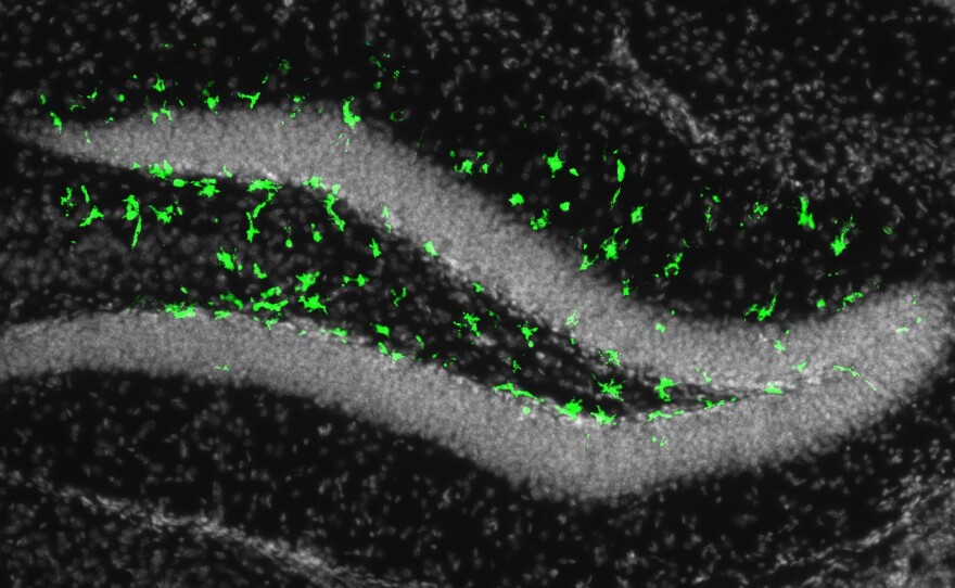 The Zika virus shows up in adult mouse brain cells from a recent experiment, Aug. 18, 2016.