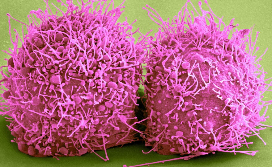 A color-enhanced scanning electron micrograph shows HeLa cells, which are commonly used in biomedical experiments. The research cell line was derived from cervical cancer cells taken from Henrietta Lacks in 1951.
